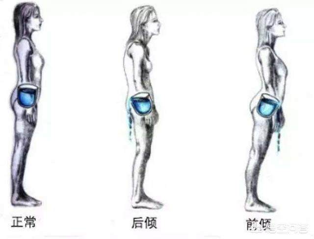 患有腰椎间盘突出的年轻人别怕,勇敢起来,医生教您如何应对